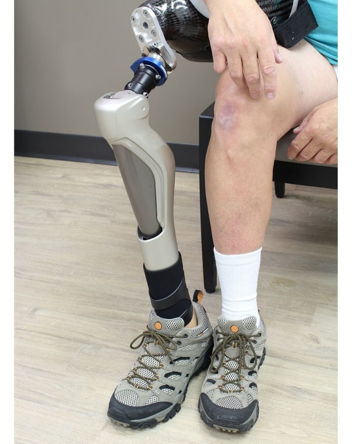 Parts Of A Prosthetic Leg